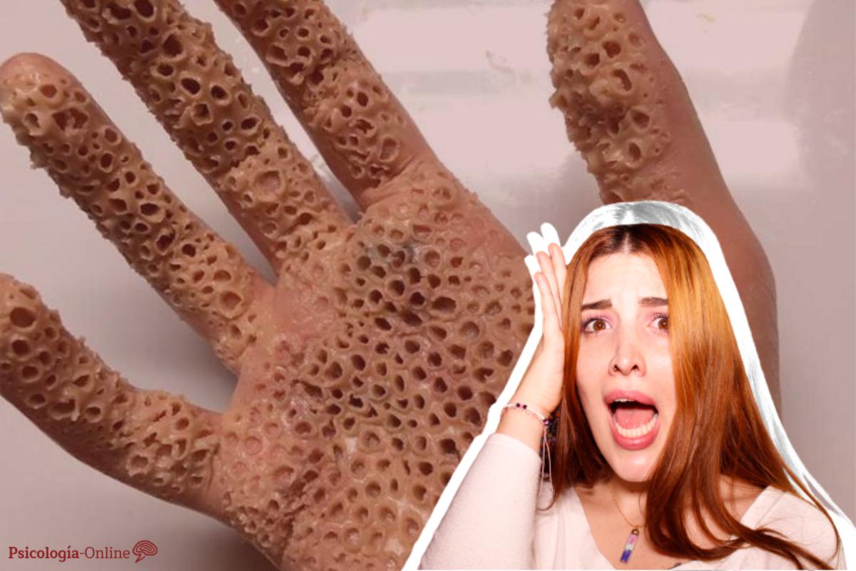 Dermatopatofobia (miedo a enfermedades de la piel): qué es, síntomas, causas y tratamiento