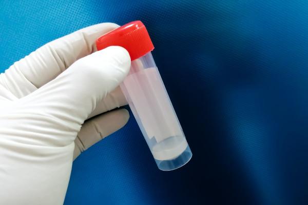 Espermatofobia o miedo al semen: qué es, causas y tratamiento - ¿Qué es la espermatofobia?