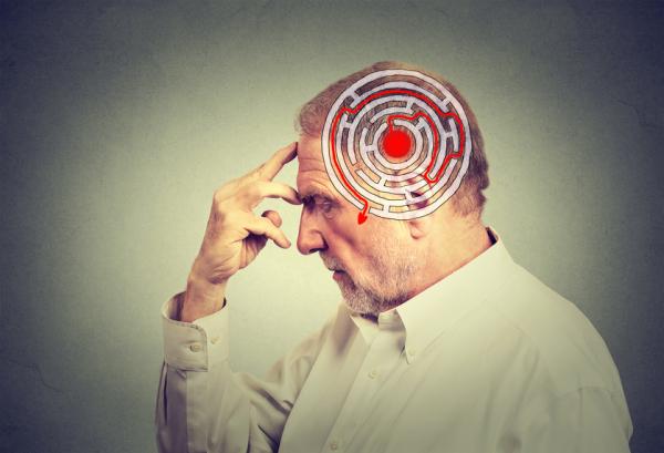Diferencia entre Alzheimer y demencia senil - Diferencia entre Alzheimer y demencia senil