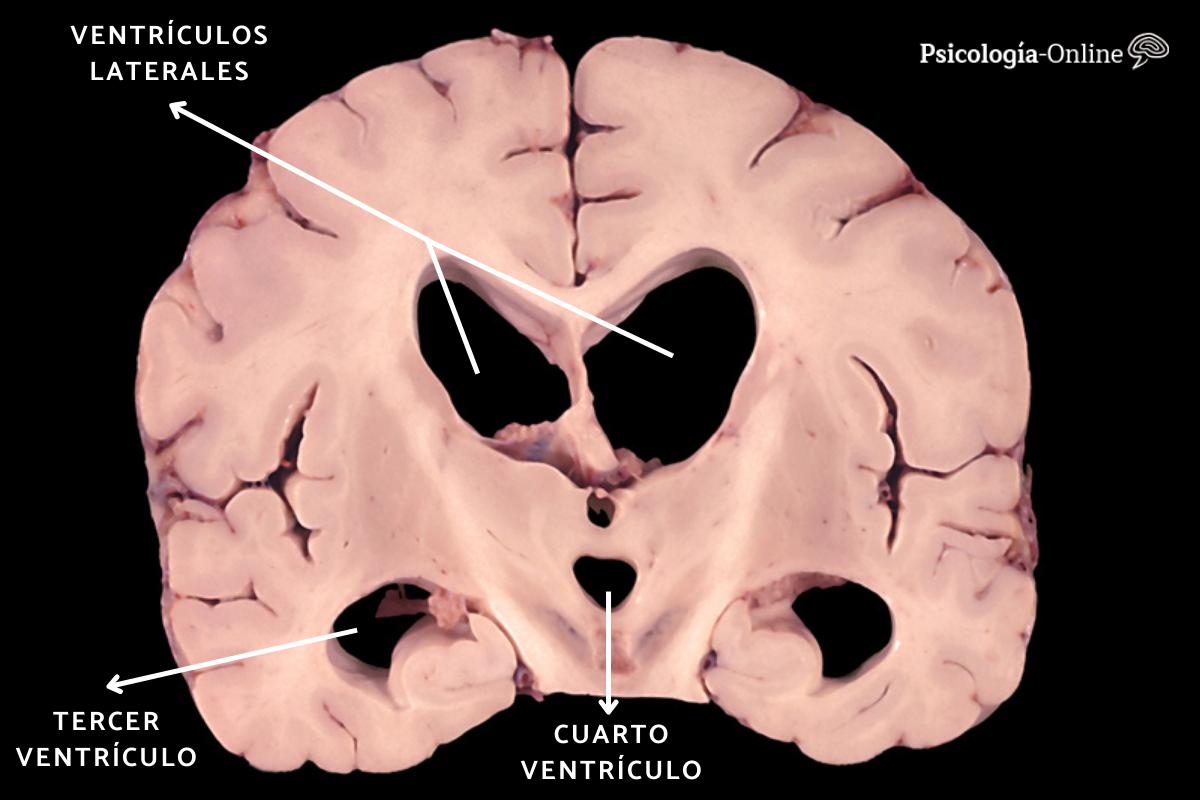 Sistema ventricular cerebral: qué es, partes y funciones