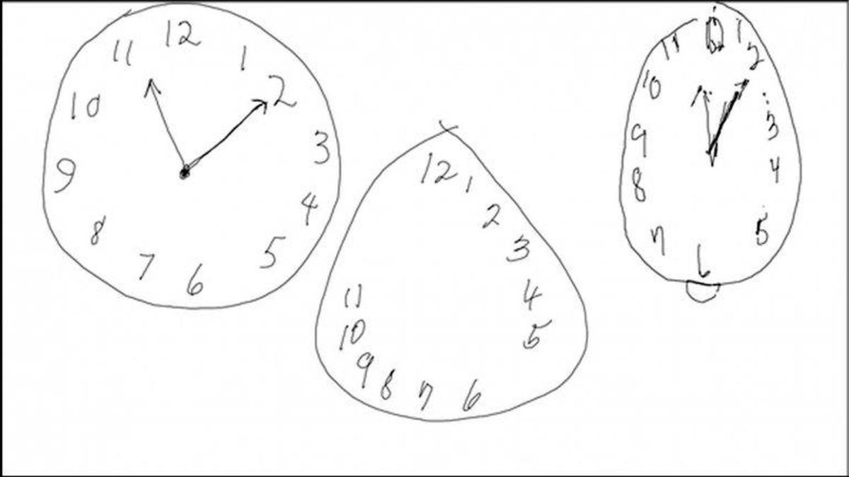 Test del reloj: qué es y cómo se hace